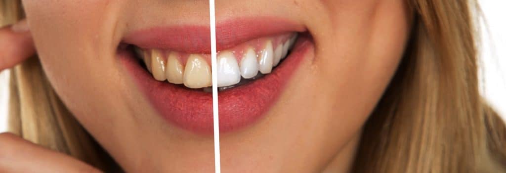 Comment avoir les dents blanches