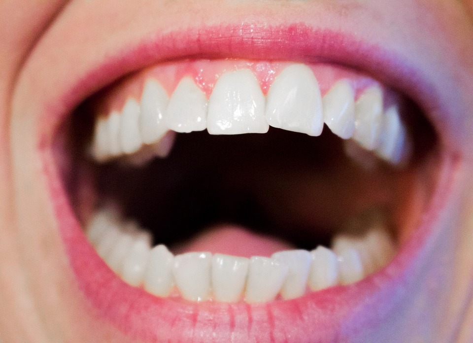 Pansement dentaire : ce qu’il faut savoir