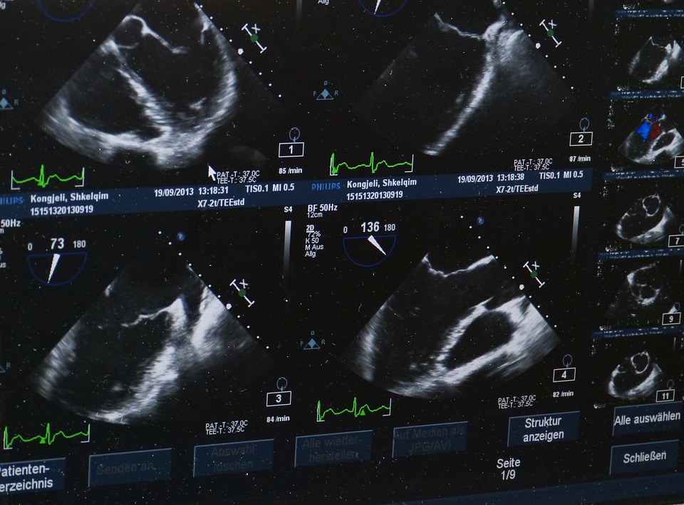 Echographie prostate : comment se déroule-t-elle ?