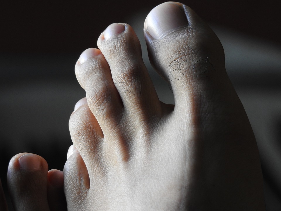 Hallux : de quoi s’agit-il ?